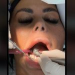 Тайната падна: Зъболекарят така разбира, че сте правили орален секс