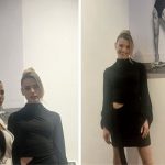 След катастрофата с Дивна моделката Кристин Илиева чукна 50 операции за възстановяването си (В изложба показа белезите си – Снимки)
