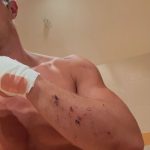 Филип Буков се размаза с велосипеда ШОК СНИМКИ
